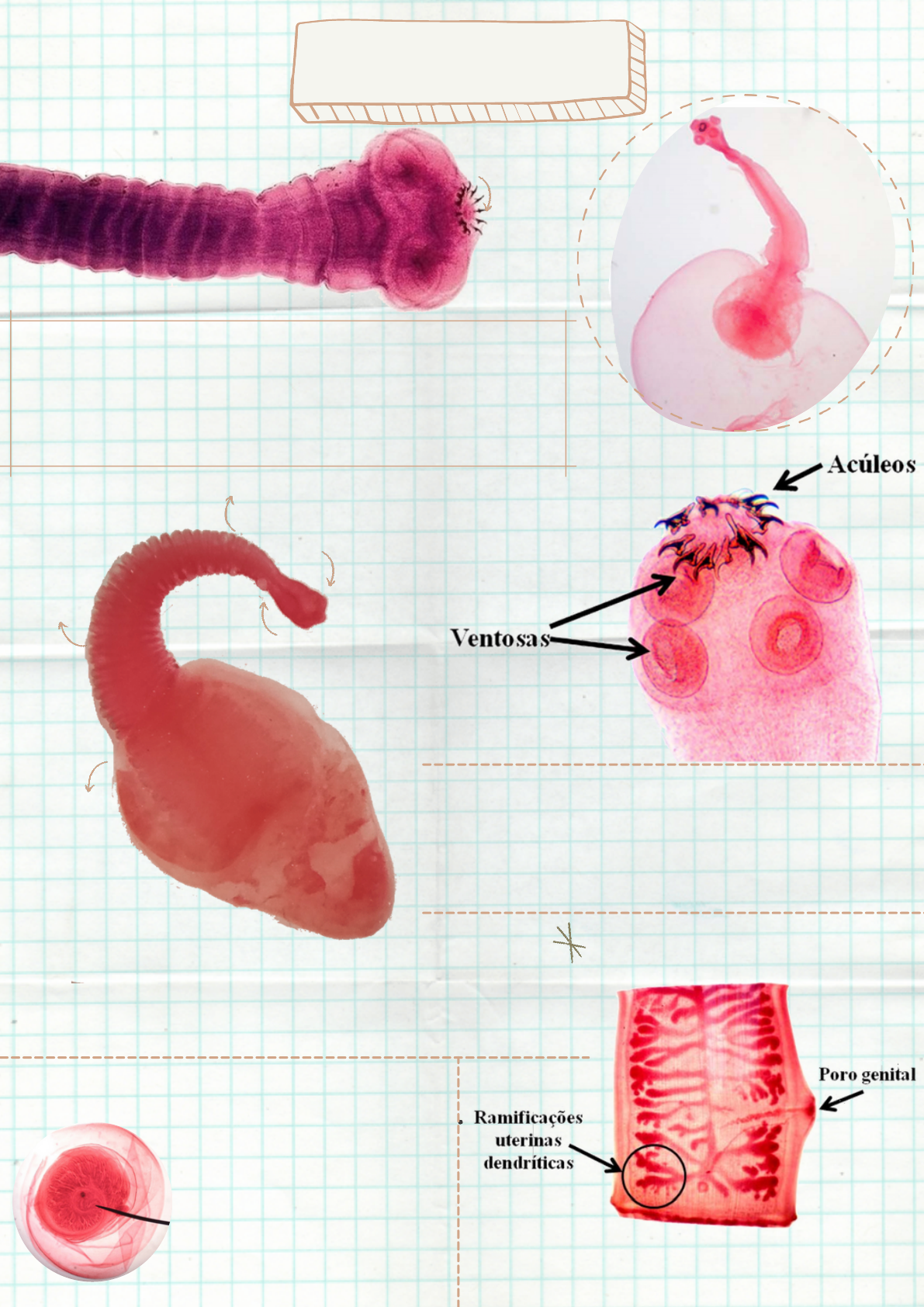 larvas de tenia solium