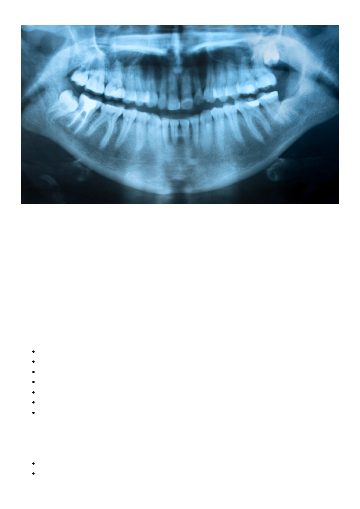 Grátis: Raio X panorâmico odontológico o que é e onde realizar - Material  Claro e Objetivo em PDF para Estudo Rápido