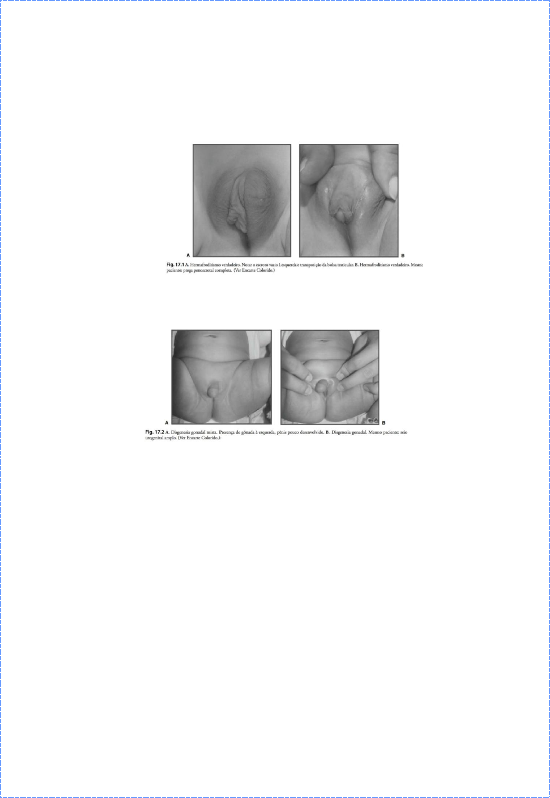 Exame físico do Aparelho Geniturinário e Osteoarticular em Pediatria -  Semiologia Médica