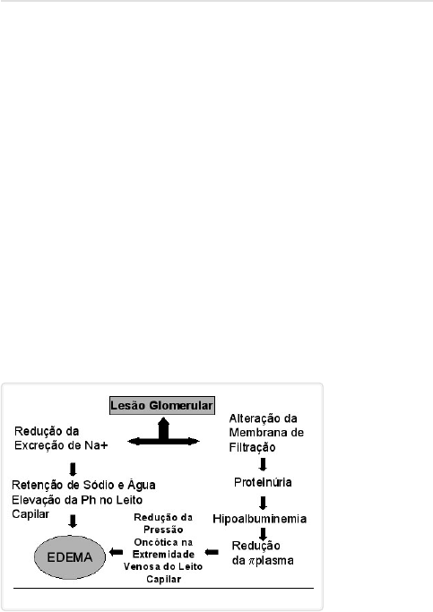 EDEMA - Patologia Geral