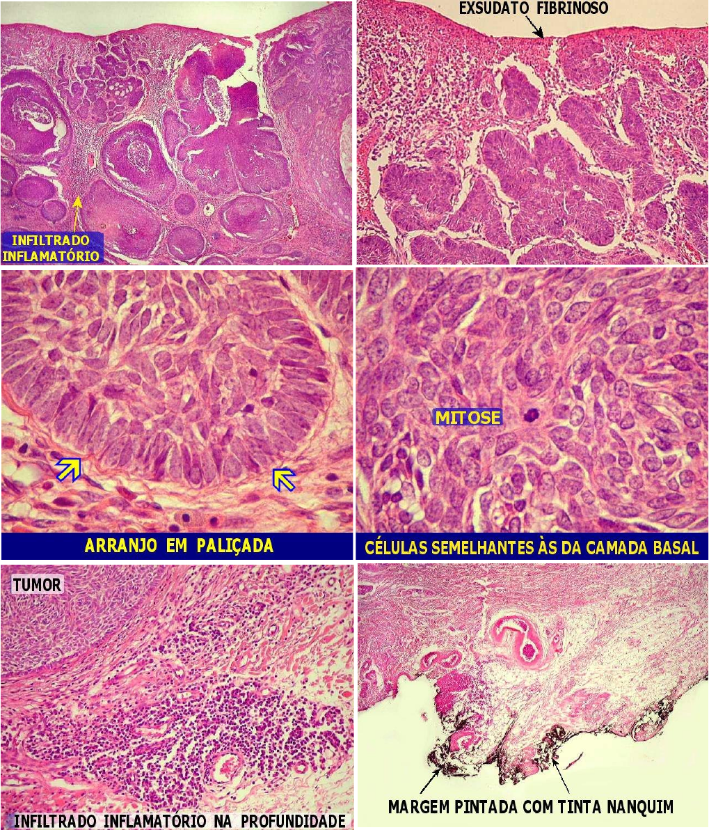 Gut-skin axis: Emerging insights for gastroenterologists-a narrative review, image size:1019x1192