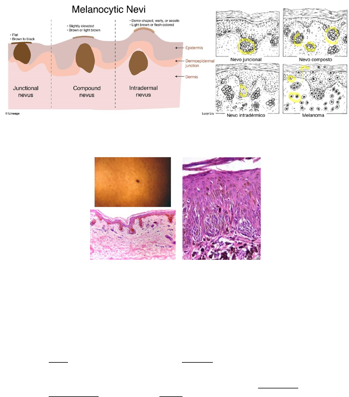 Bolhas brancas no corpo do pênis. Por favor, ajudem : r/DiagnoseMe, image size:1182x1343