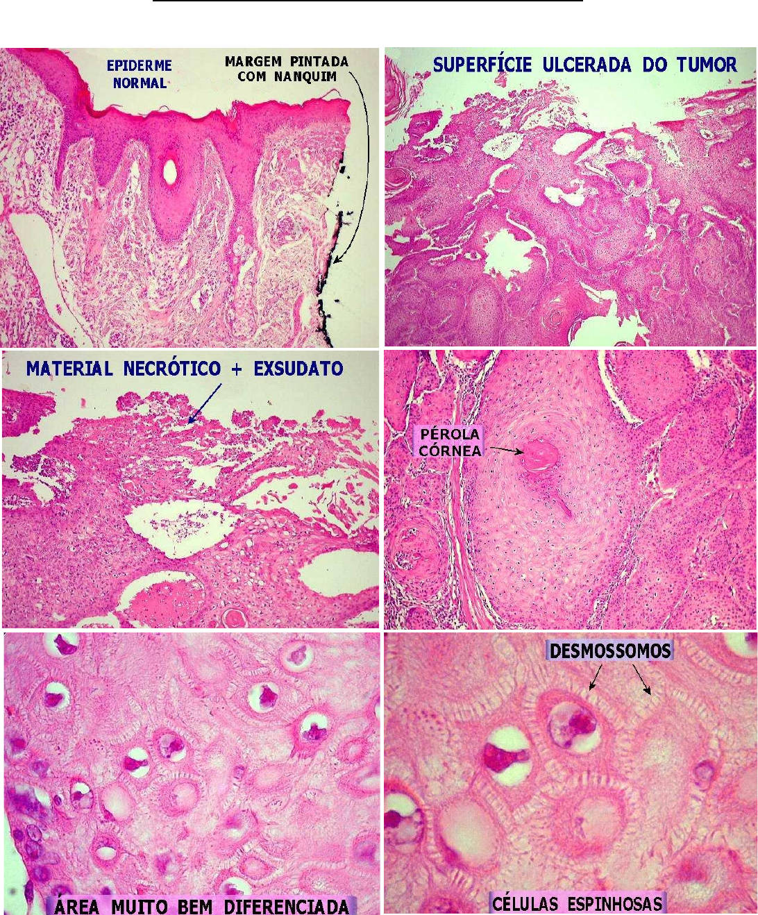 Grátis: TUMORES DA PELE - Material Claro e Objetivo em PDF para Estudo  Rápido, image size:1092x1318