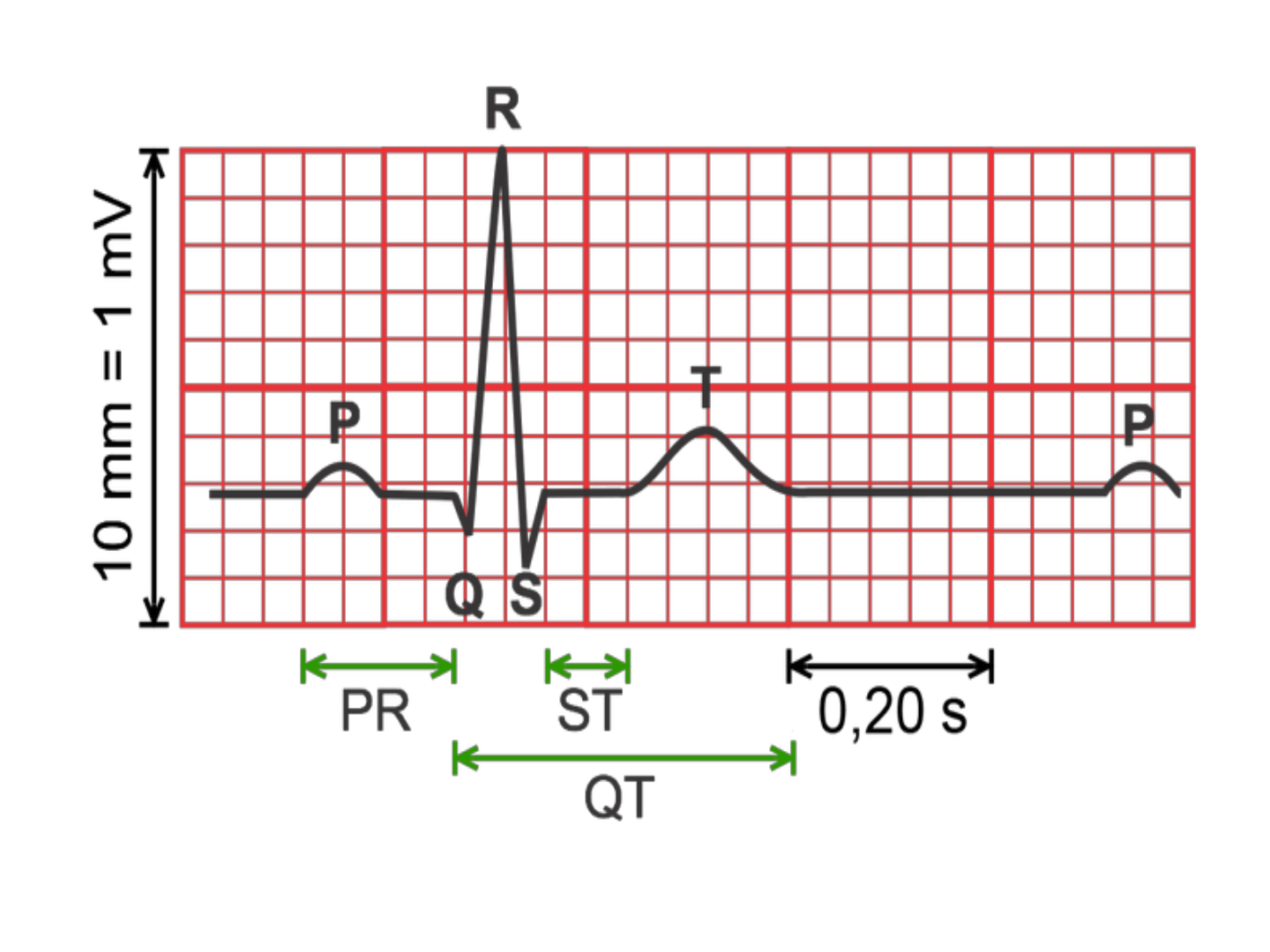 Grátis: ECG - Eletrocardiograma - Material Claro e Objetivo em PDF