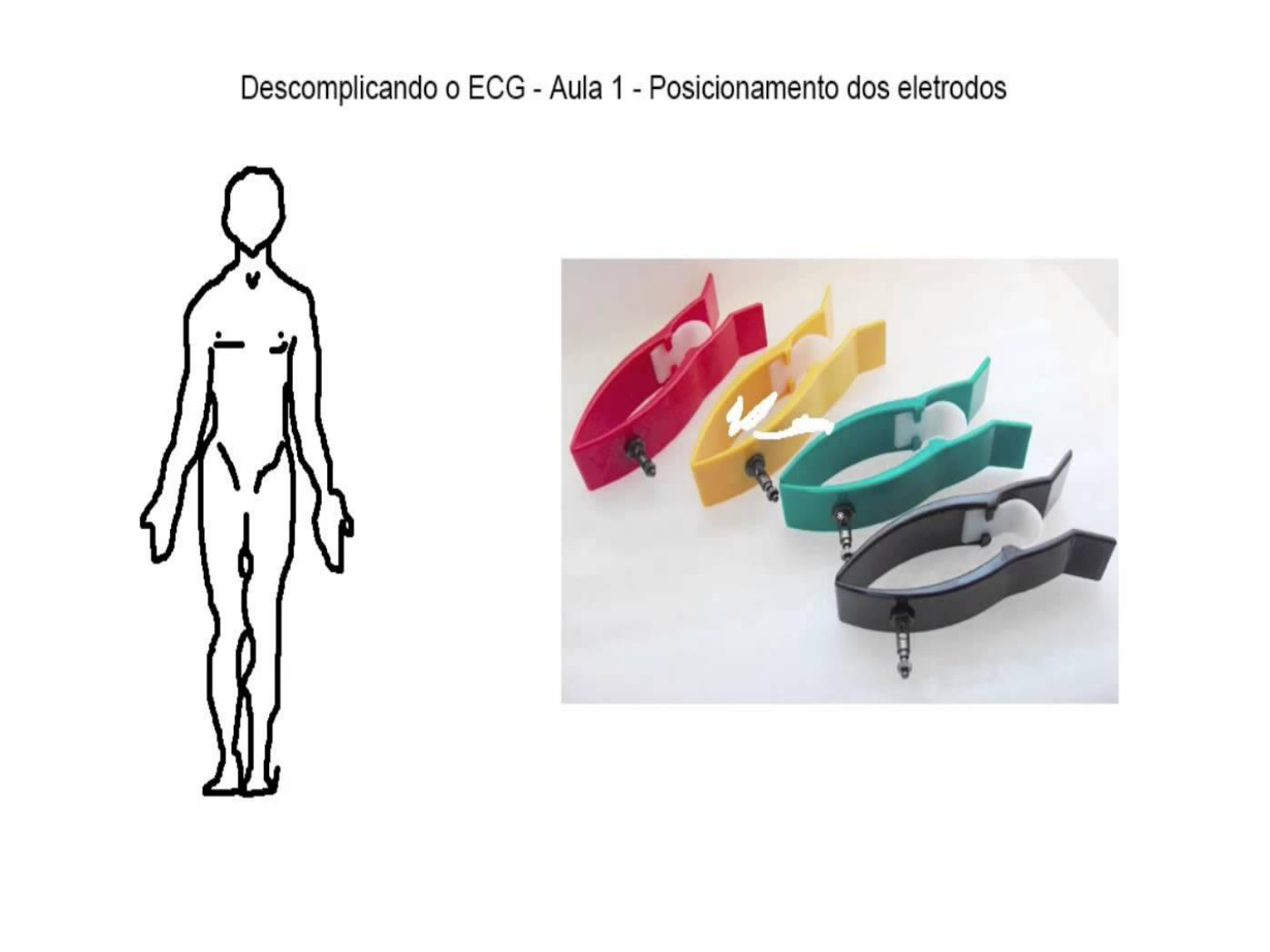 Grátis: ECG - Eletrocardiograma - Material Claro e Objetivo em PDF