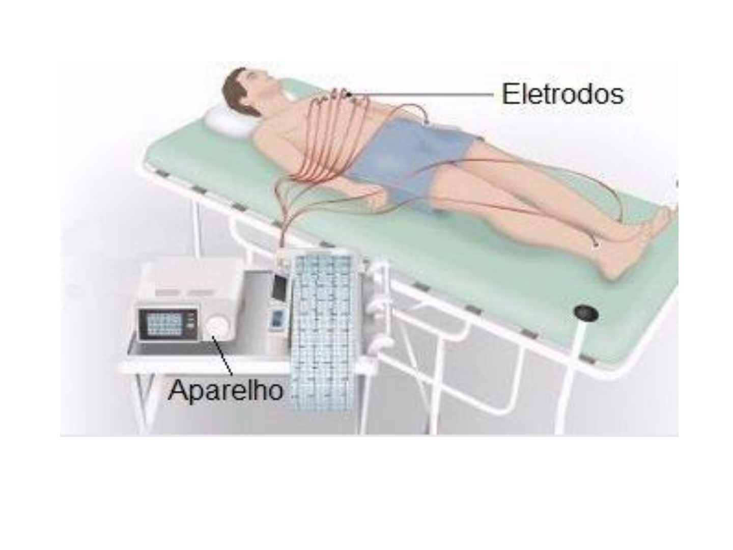 Grátis: ECG - Eletrocardiograma - Material Claro e Objetivo em PDF