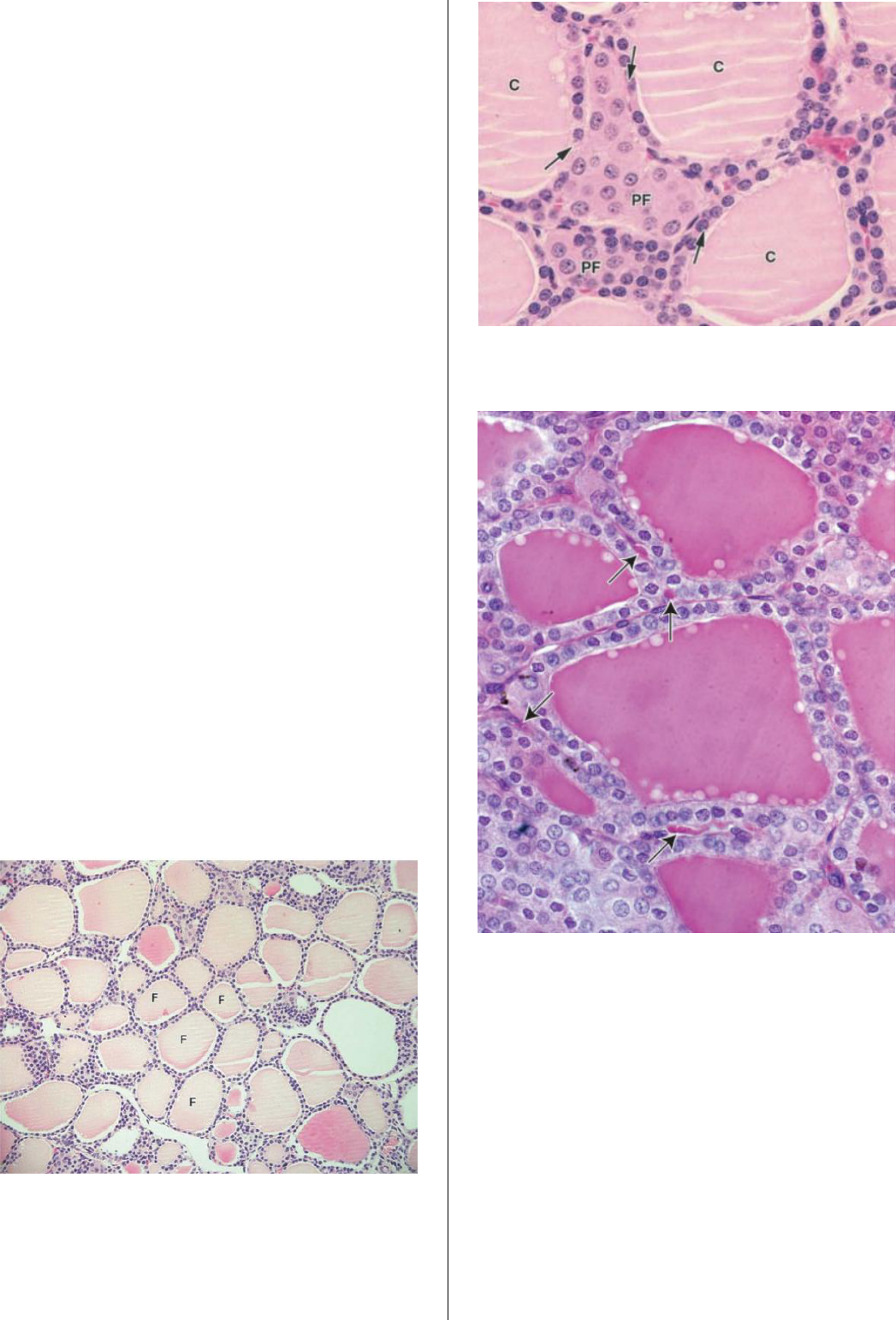 Histologia Da Paratireoide Rotulada