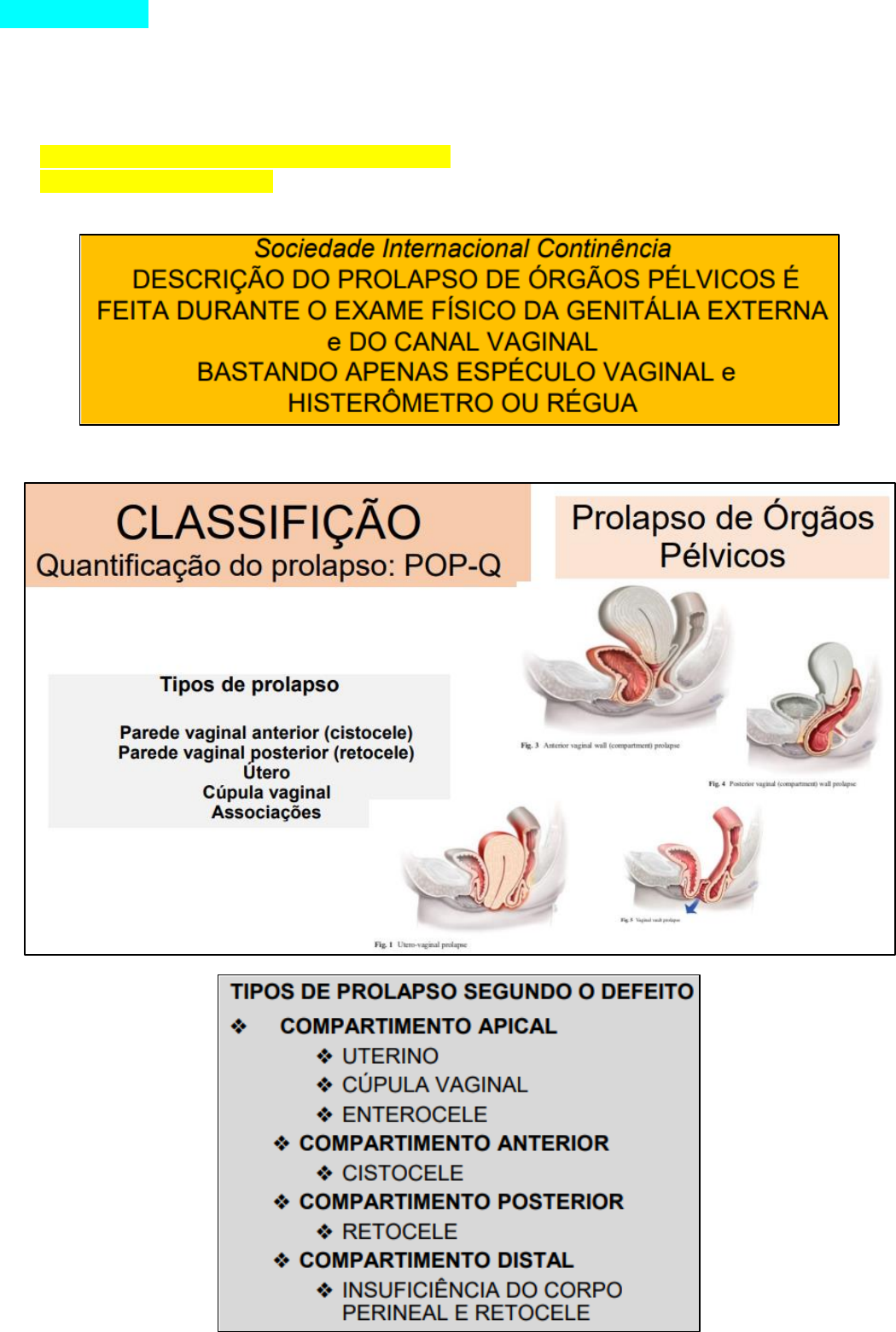 Classificacao Do Prolapso Vaginal Prolapso Genital: O Que é? Como
