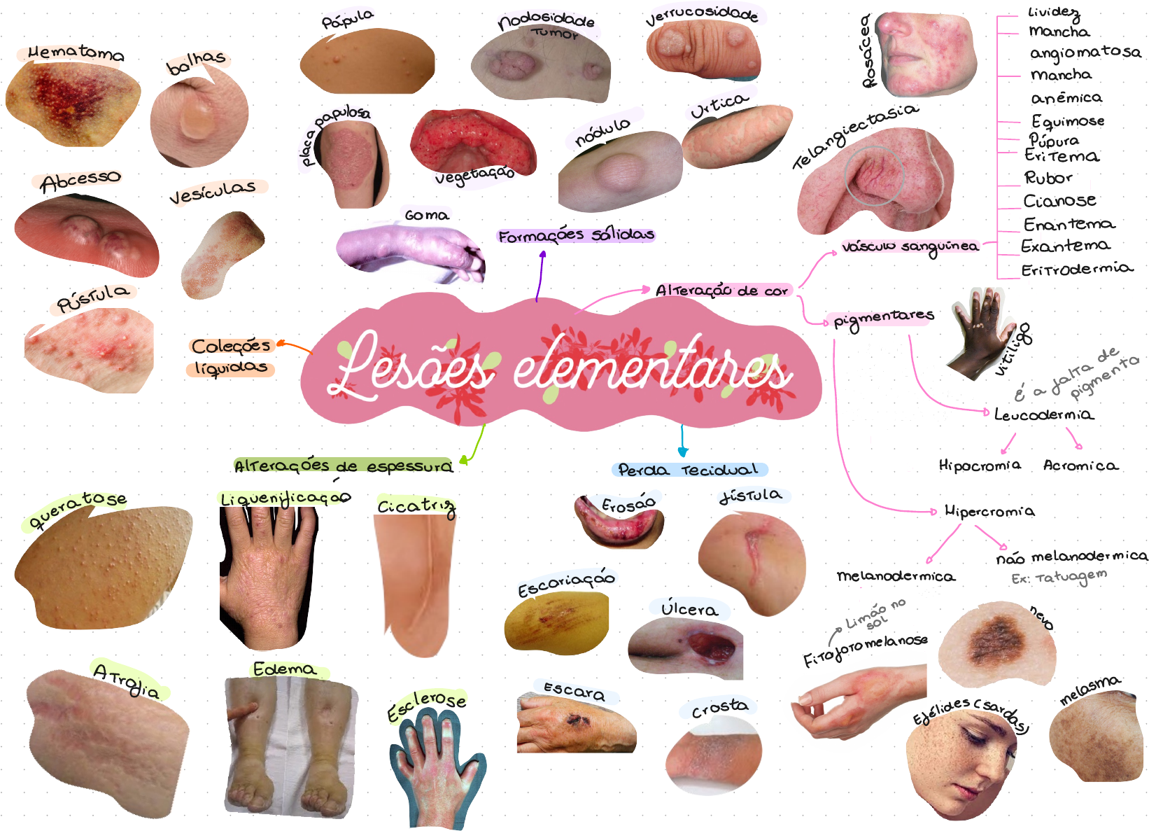 Lesões Elementares Em Dermatologia - REVOEDUCA