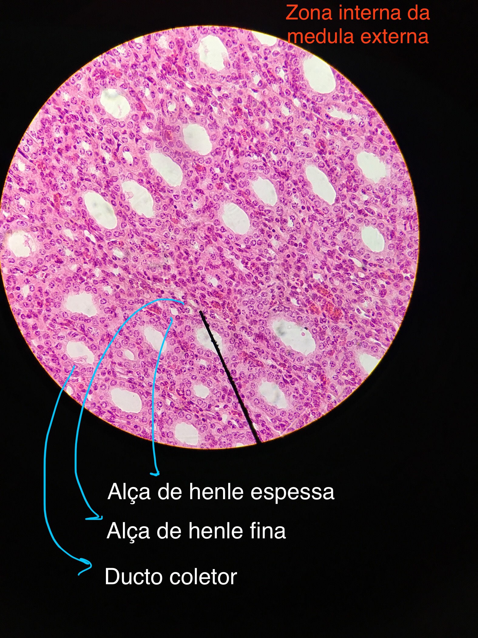 Rim Zona Interna Da Medula Externa Histologia I