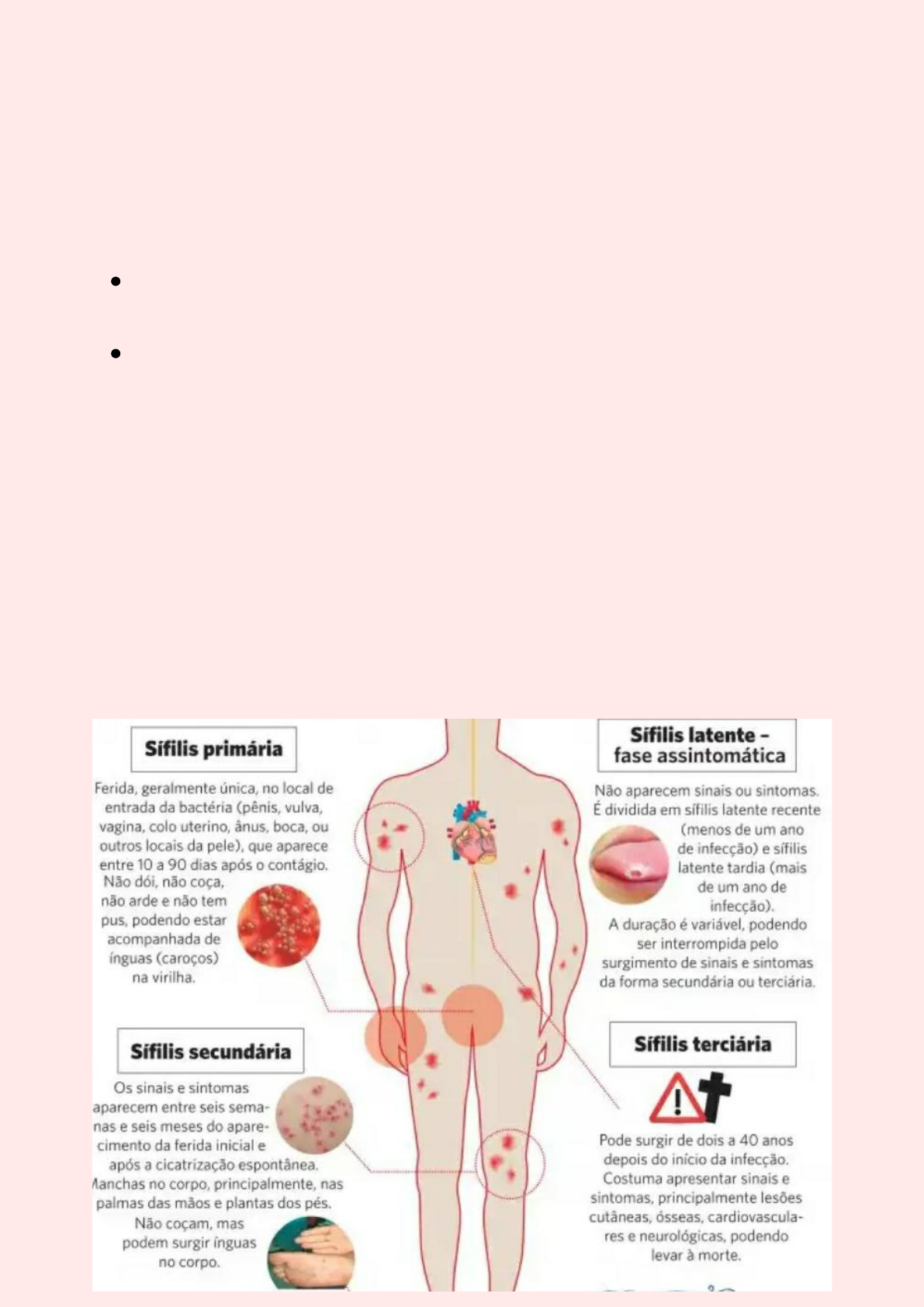 Infecções Sexualmente Transmissíveis IST'S   GD   Saúde da Mulher