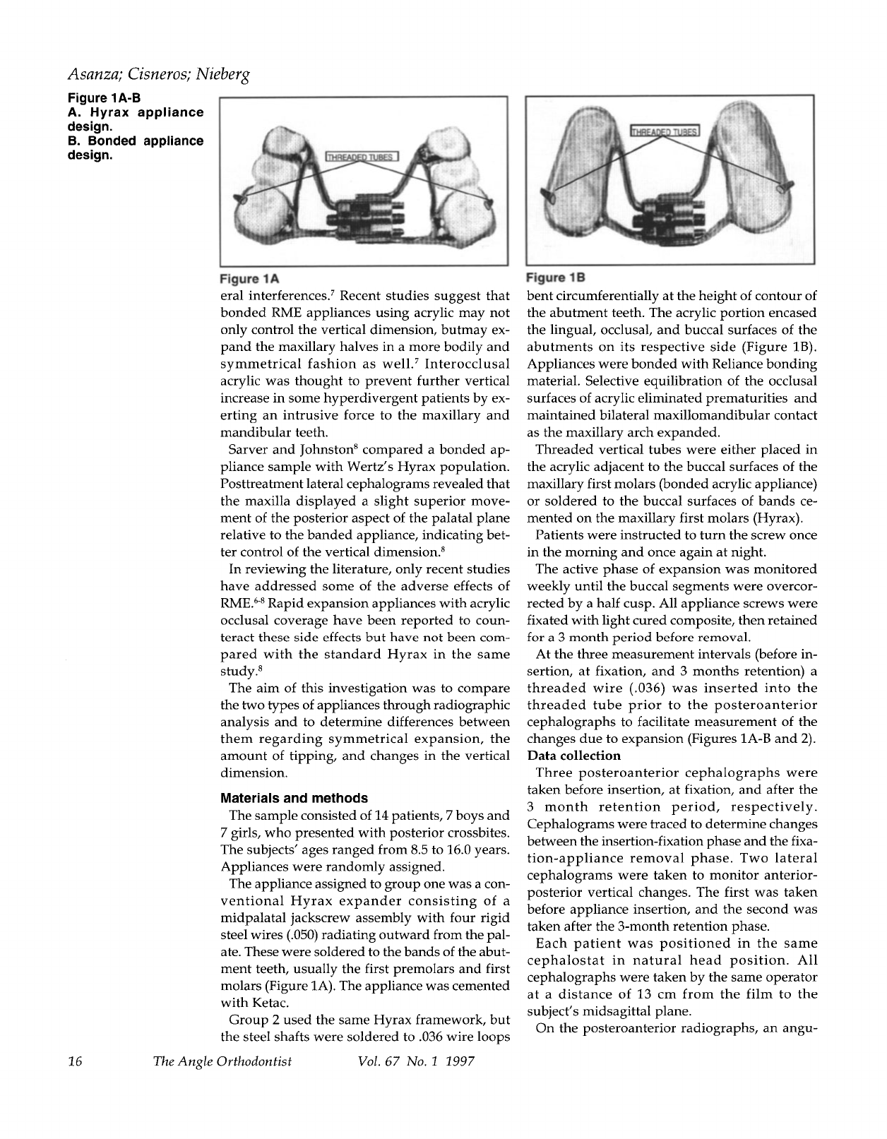 Comparison of Hyrax and bonded expansion appliances - Ortodontia