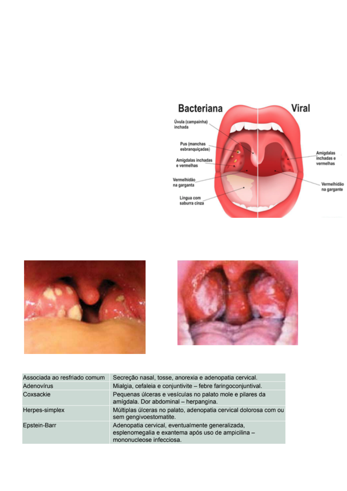 Grátis: Faringoamigdalites: causas, sintomas e diagnóstico - Material Claro  e Objetivo em PDF para Estudo Rápido, image size:1191x1684