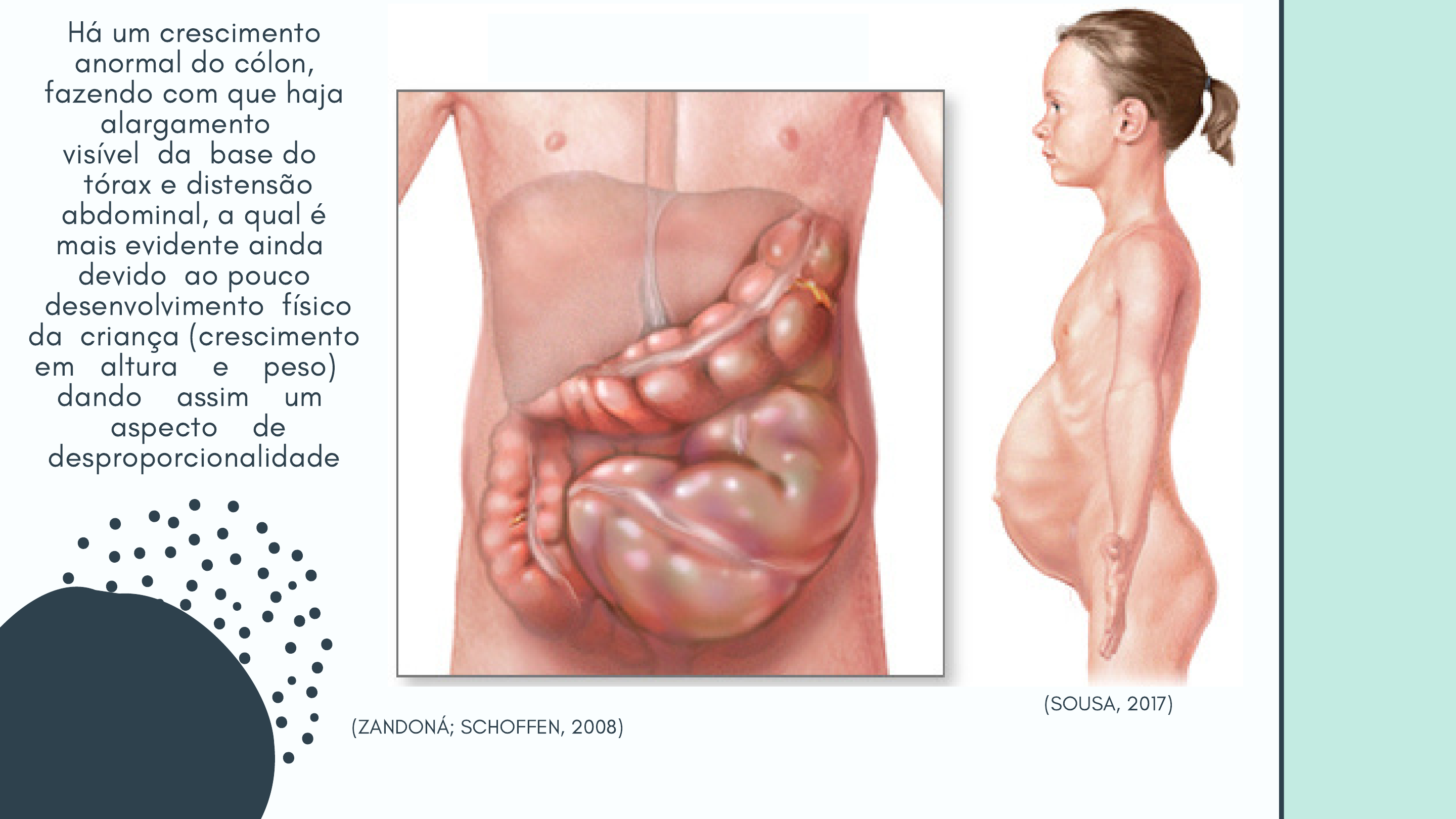 PPT - Manometria Anorretal como instrumento diagnóstico nos distúrbios da  defecação em crianças e adolescentes PowerPoint Presentation - ID:969793, image size:2880x1620
