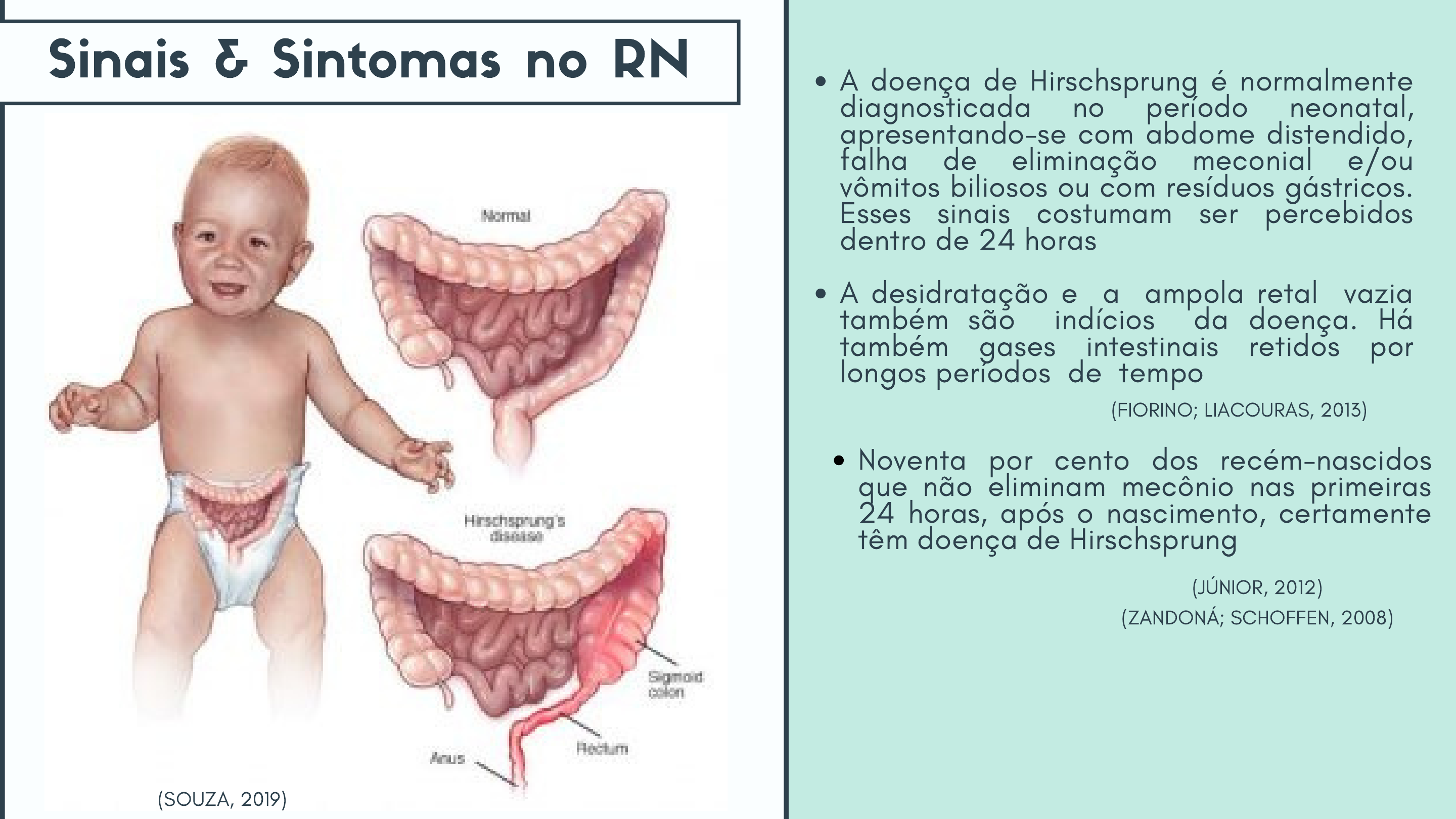 Megacólon: Acompanhamento e Cuidados na Adultice, image size:2880x1620