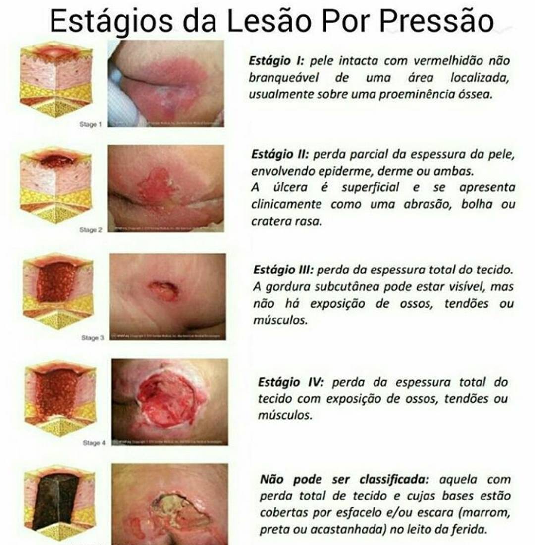 Tipos De Lesao Corporal Ensino