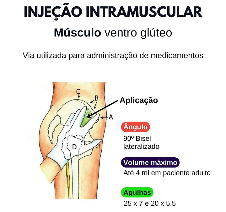 glúteo ventrodorsal