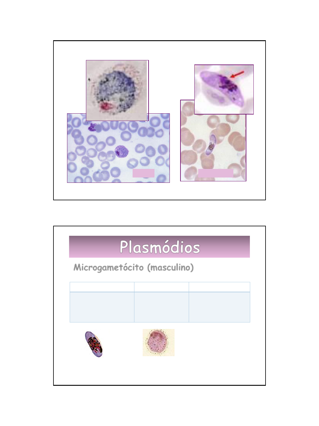 microgametocito de plasmodium vivax