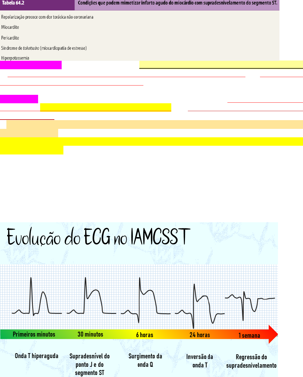 Isquemia miocárdica: causas, fatores de risco, sintomas, tratamento, image size:1042x1296