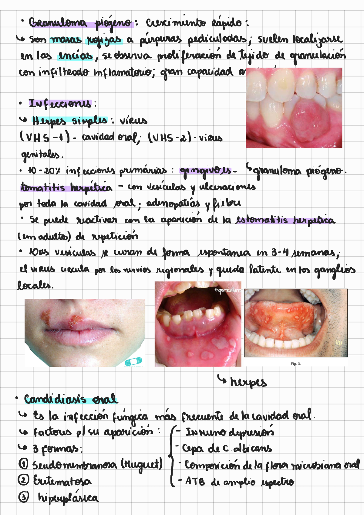 Patologias De La Cavidad Oral Anatomia Patol Gica The Best Porn Website