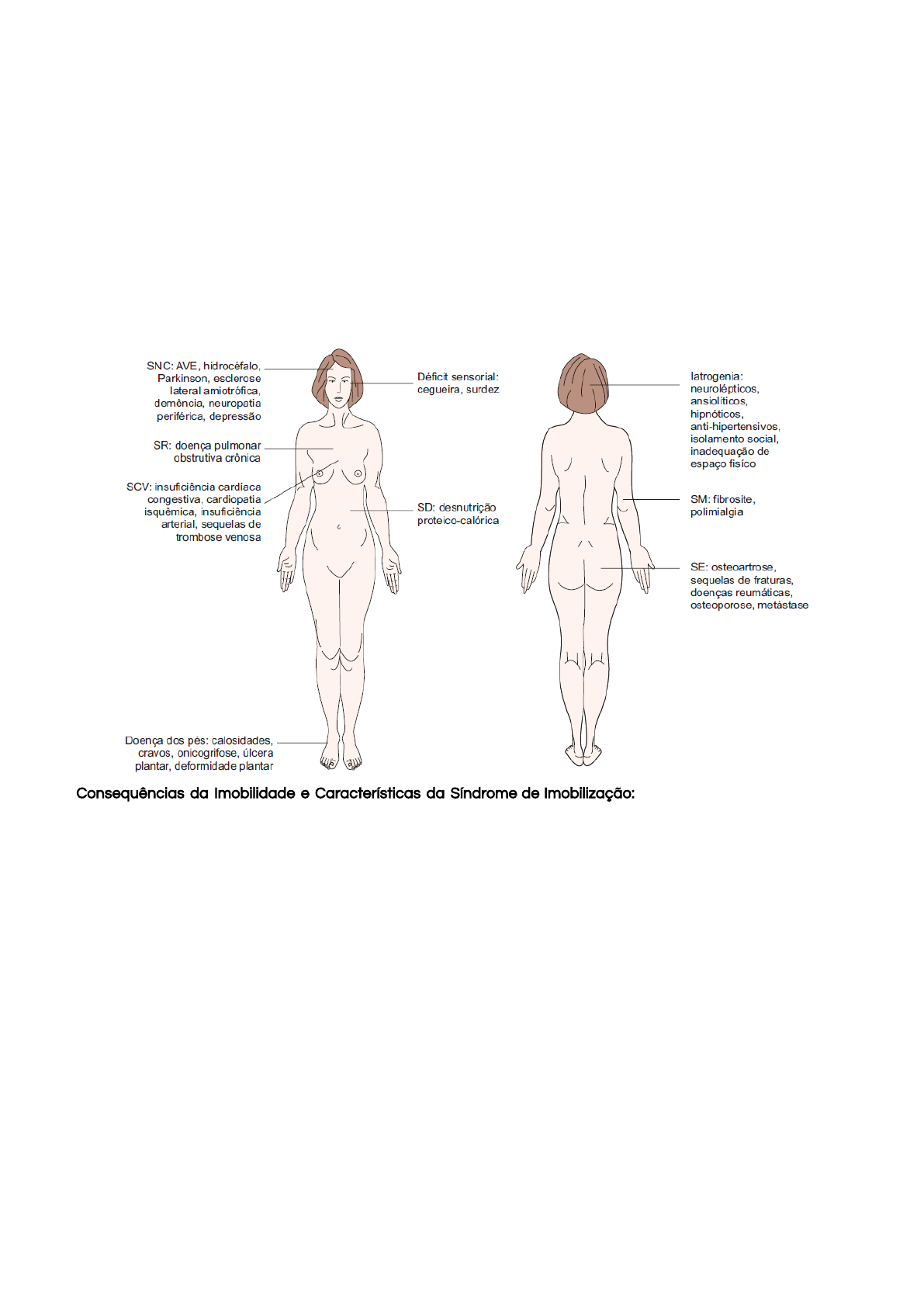 Vestimenta de compressão na síndrome de taquicardia ortostática postural