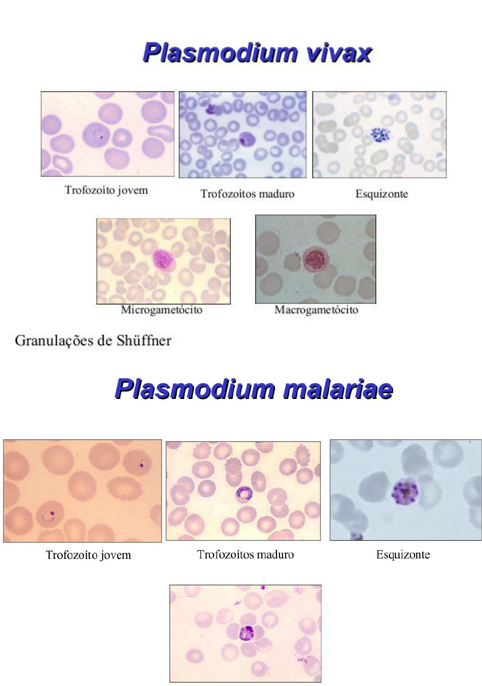 microgametocito de plasmodium vivax