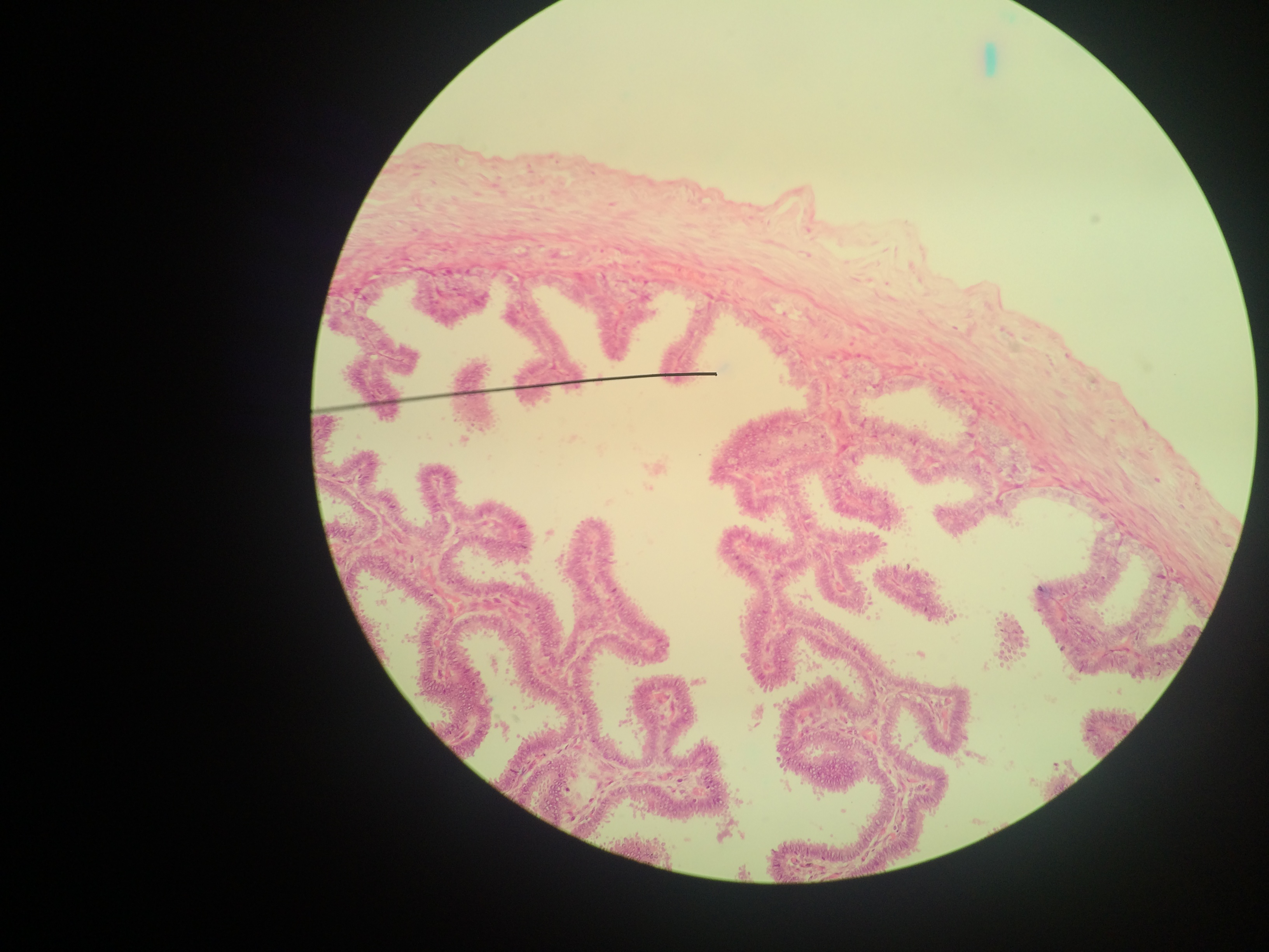 1. Tuba uterina Embriologia Básica