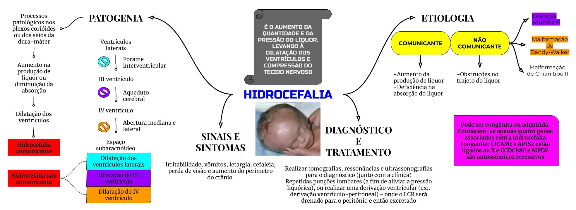 Hidrocefalia Mapa Mental Fisioterapia Neurofuncional 7762