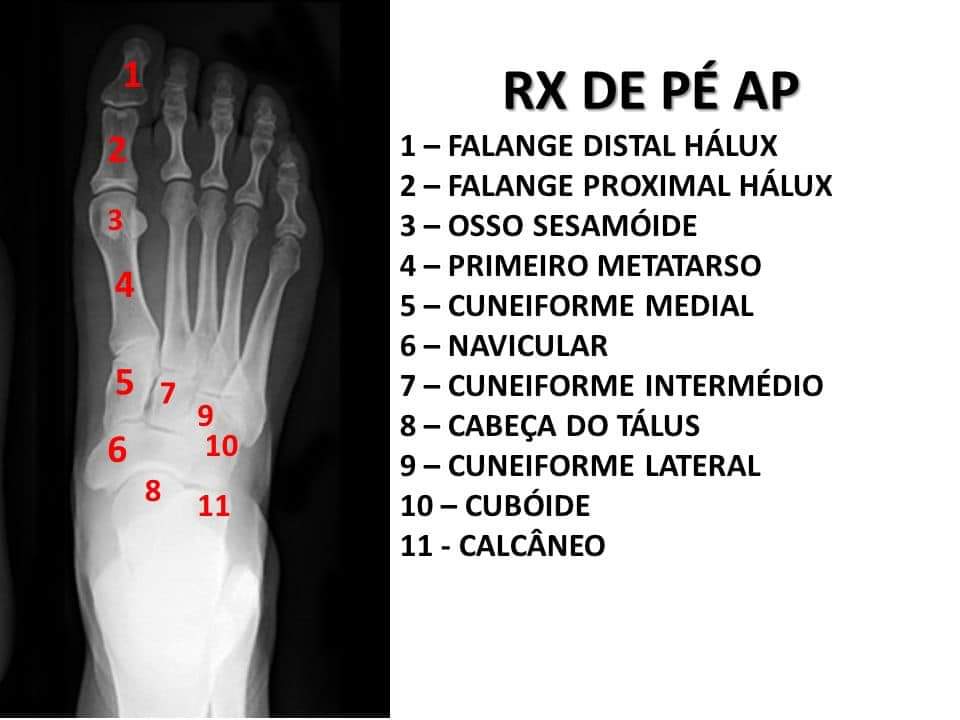 Anatomia Radiologica Tecnólogo Em Radiologia