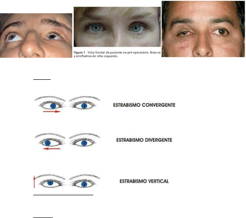 Robbins \u0026 Cotran Bases Patológicas Das Doenças - Hepato | PDF | Hepatite |  Bile, image size:1042x921
