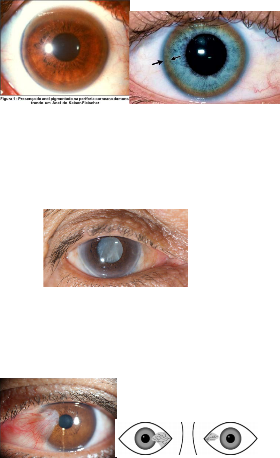 Grátis: Exame físico OLHO - Material Claro e Objetivo em PDF para Estudo  Rápido, image size:928x1516