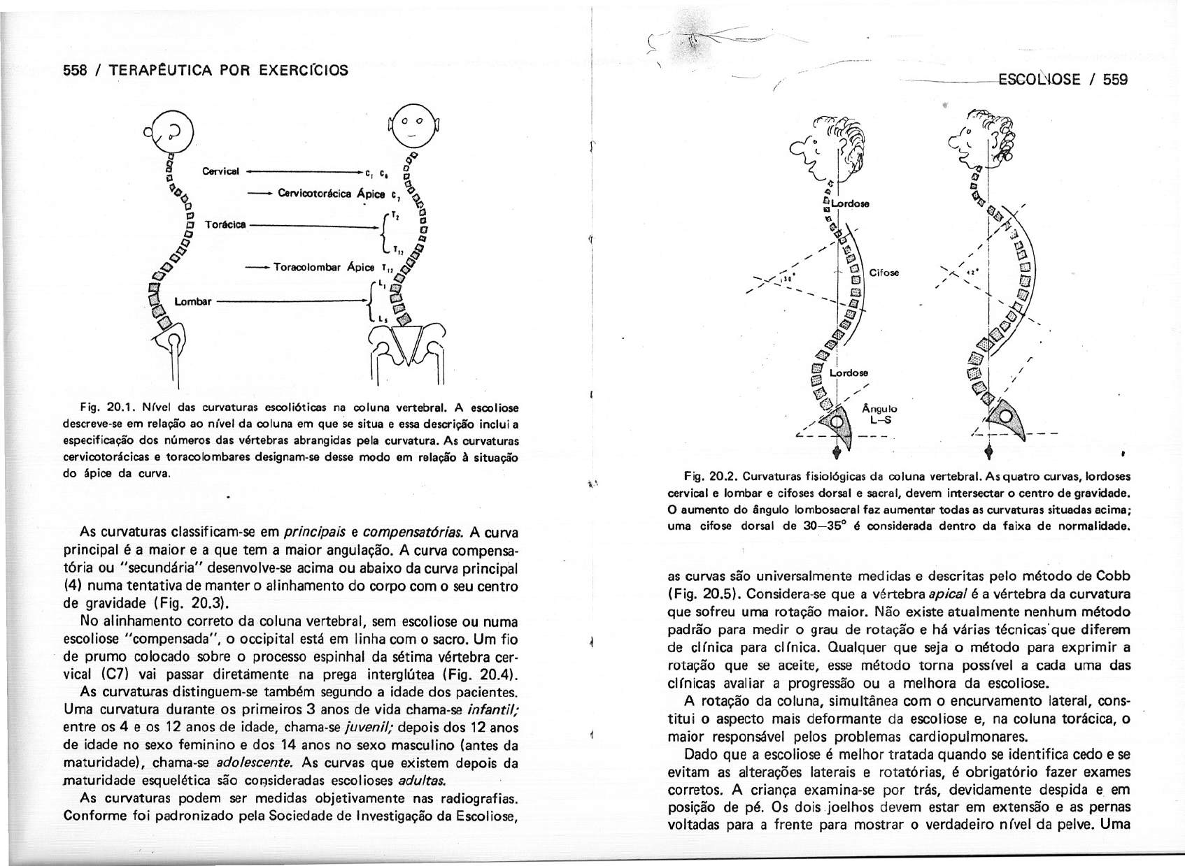 Tratamento para Hiper cifose – João Pedro Soares, image size:1694x1239