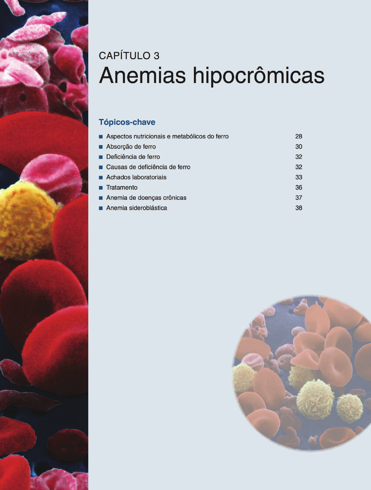 Capitulo Anemias Hipocrômica Hematologia