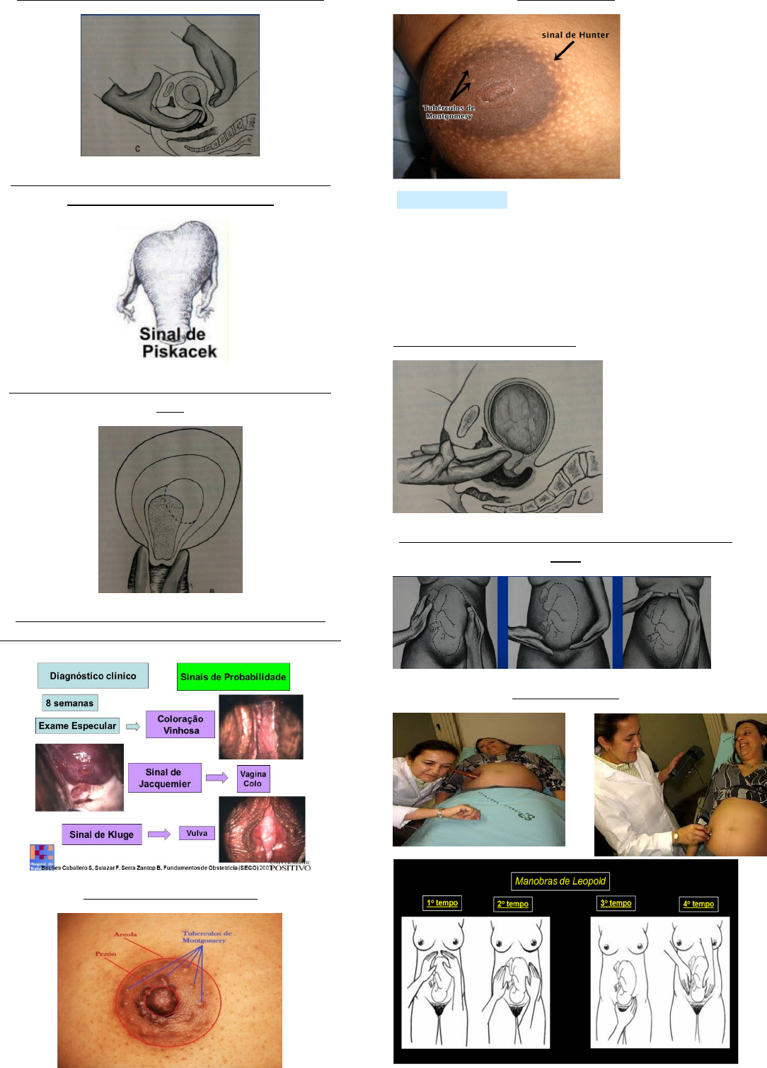 Sinais de Gravidez - Obstetrícia