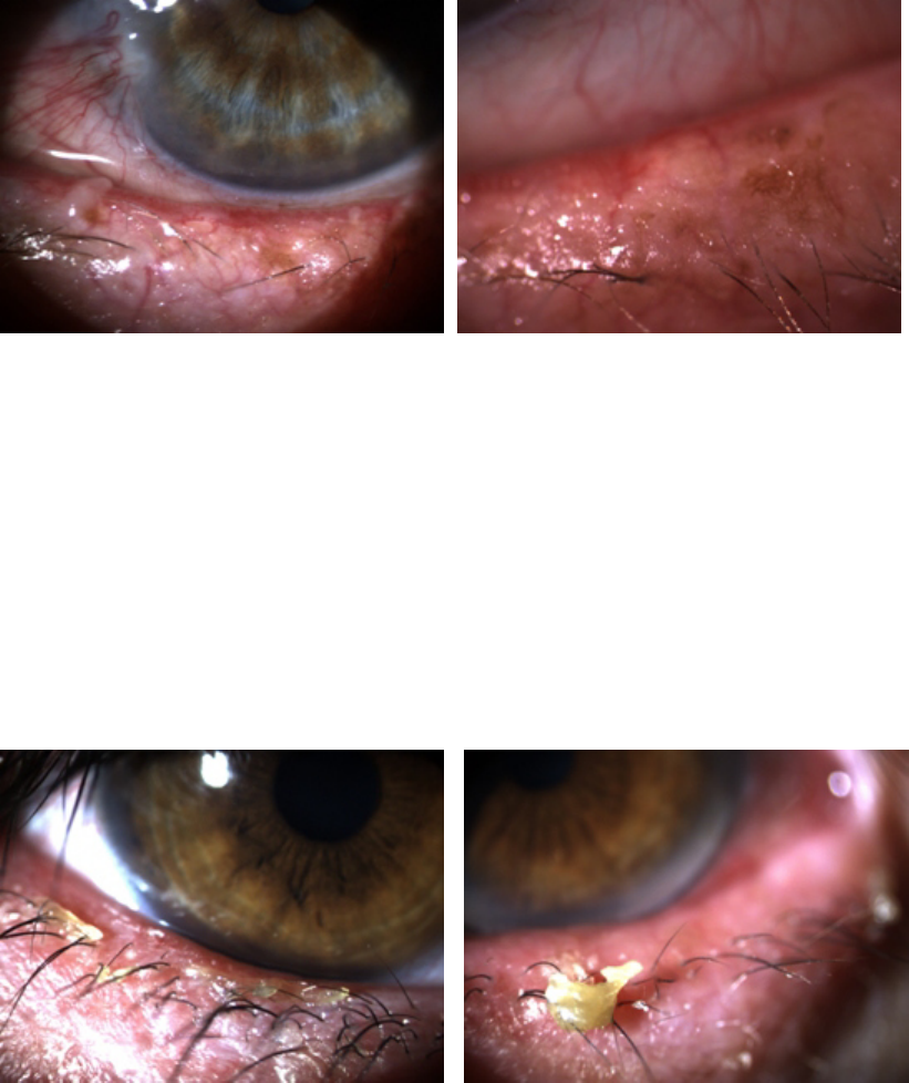 Grátis: 4 - palpebra - Material Claro e Objetivo em PDF para Estudo Rápido
