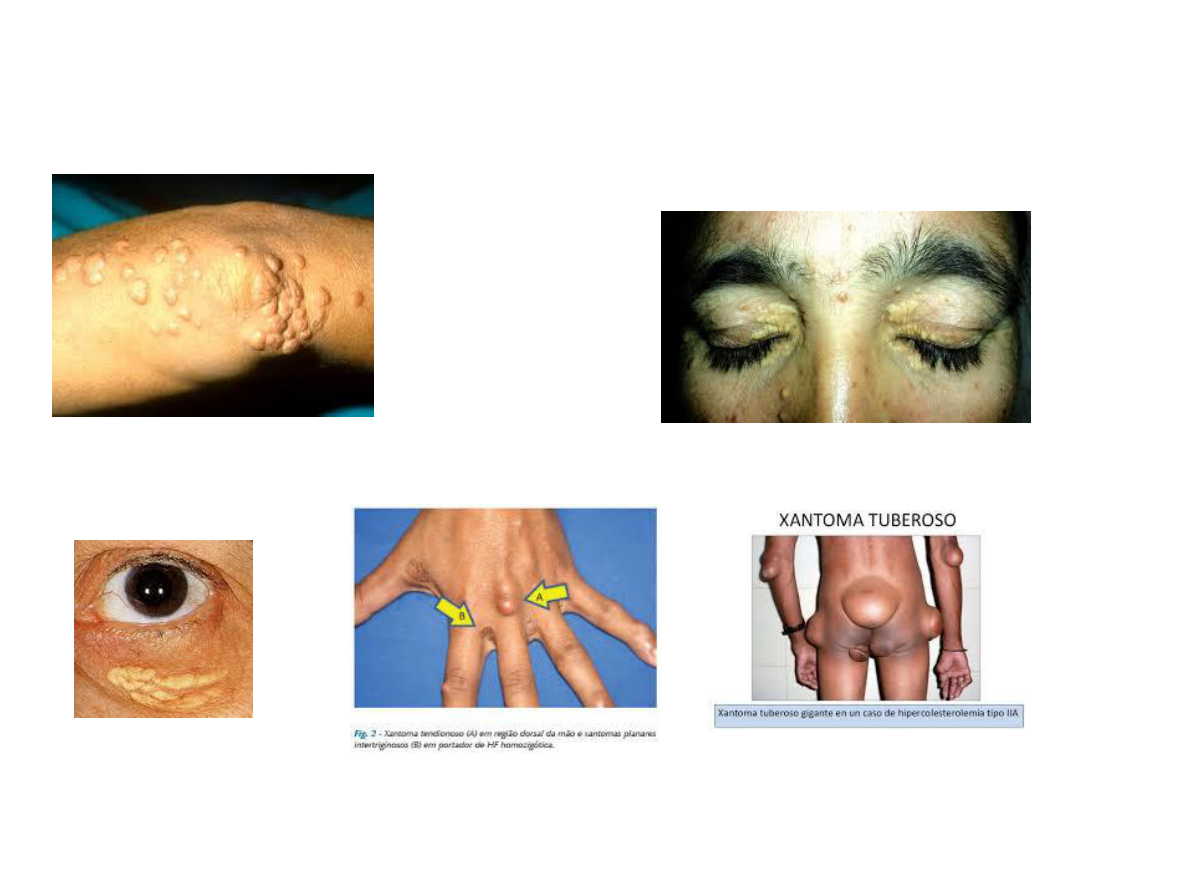 Grátis: Degenerações celulares - Material Claro e Objetivo em PDF para  Estudo Rápido, image size:1190x893