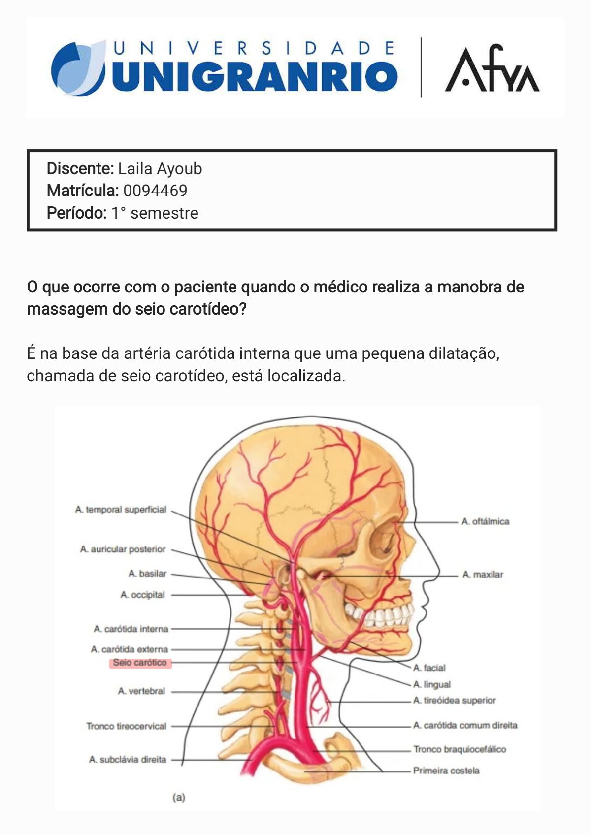 Massagem do seio carotídeo - Sistemas Orgânicos Integrados I