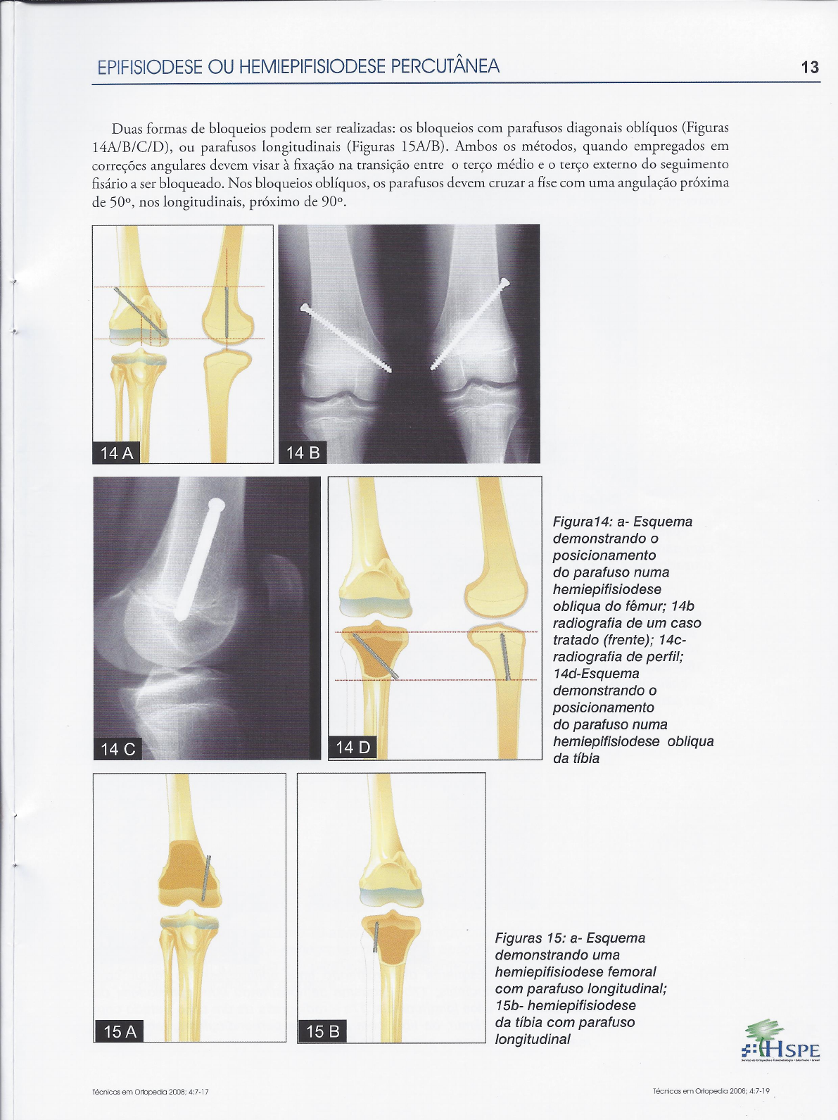 Anestesia e Analgesia Epidural - NYSORA, image size:1191x1591
