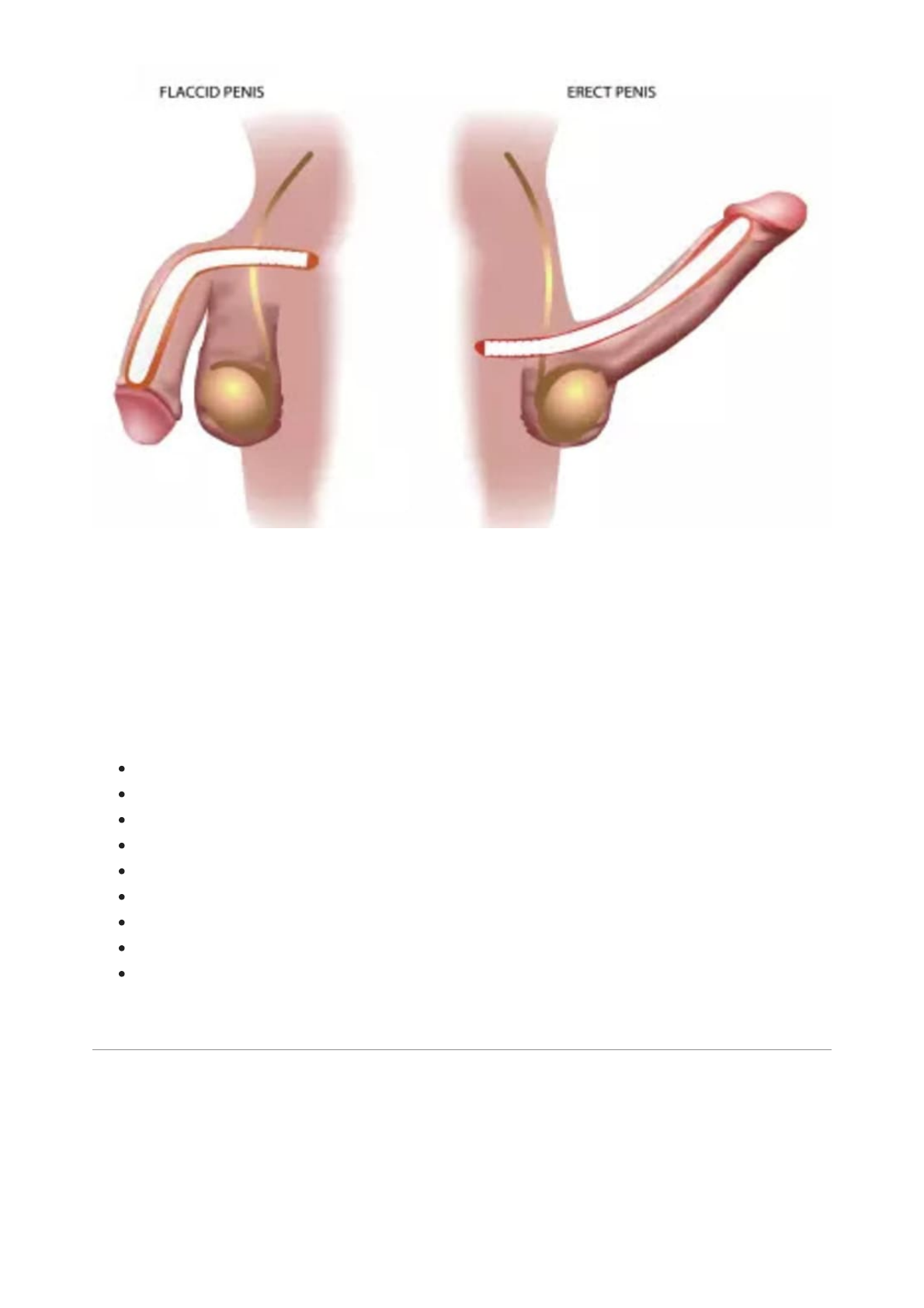 Como funcionam os implantes penianos - Clínica Médica I