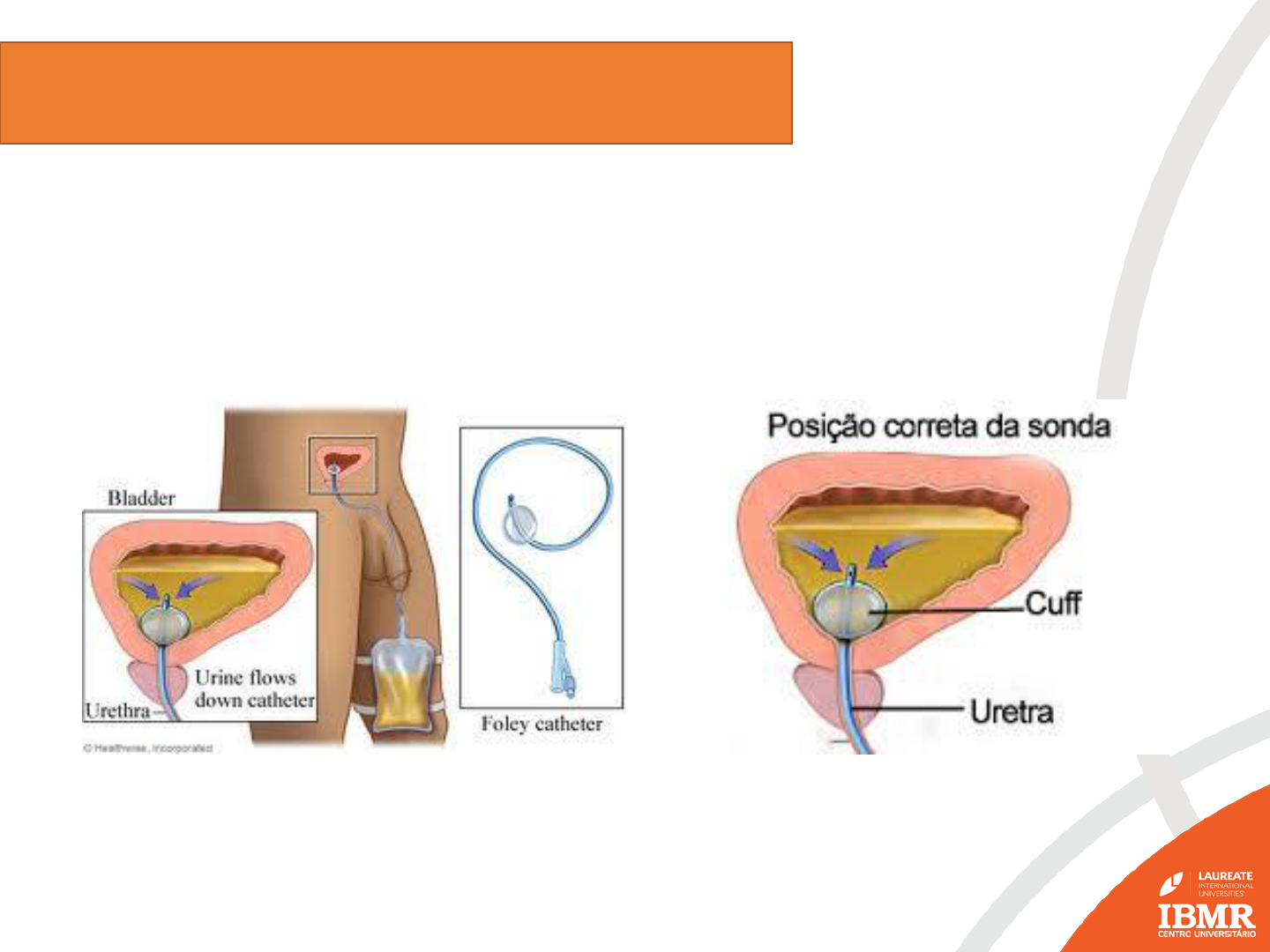 Grátis: Aula - Cateterismo Vesical - Material Claro e Objetivo em PDF para  Estudo Rápido