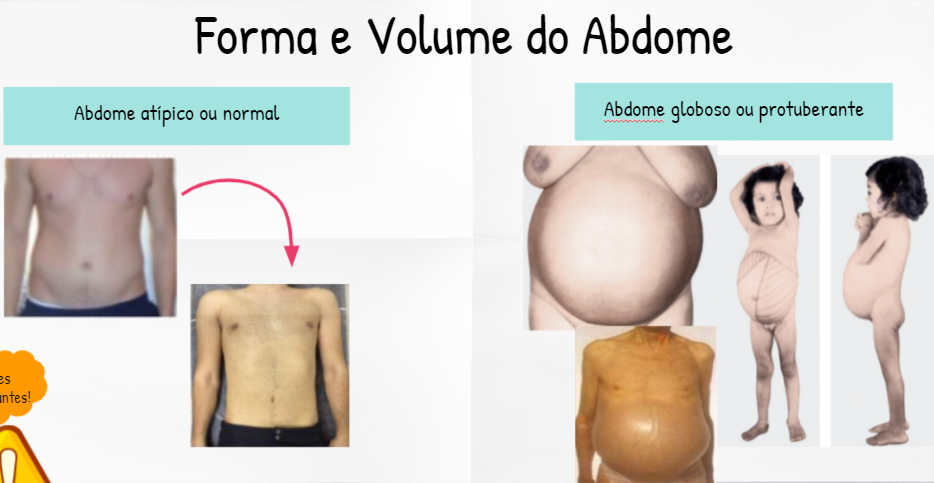 Formas e Volumes do abdome Semiologia Médica