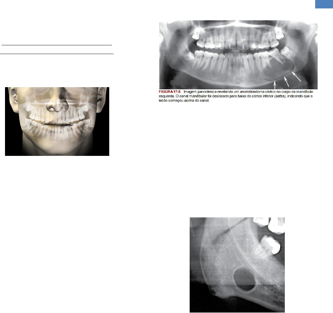 Radiologia - Diagnóstico diferencial - Radiologia Odontológic