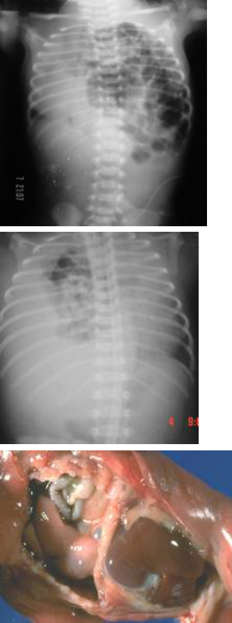 Rio Day Hospital - A hérnia inguinal é uma protuberância que surge na  virilha, especialmente em homens, que ocorre quando uma parte do intestino  sai através de um ponto fraco dos músculos