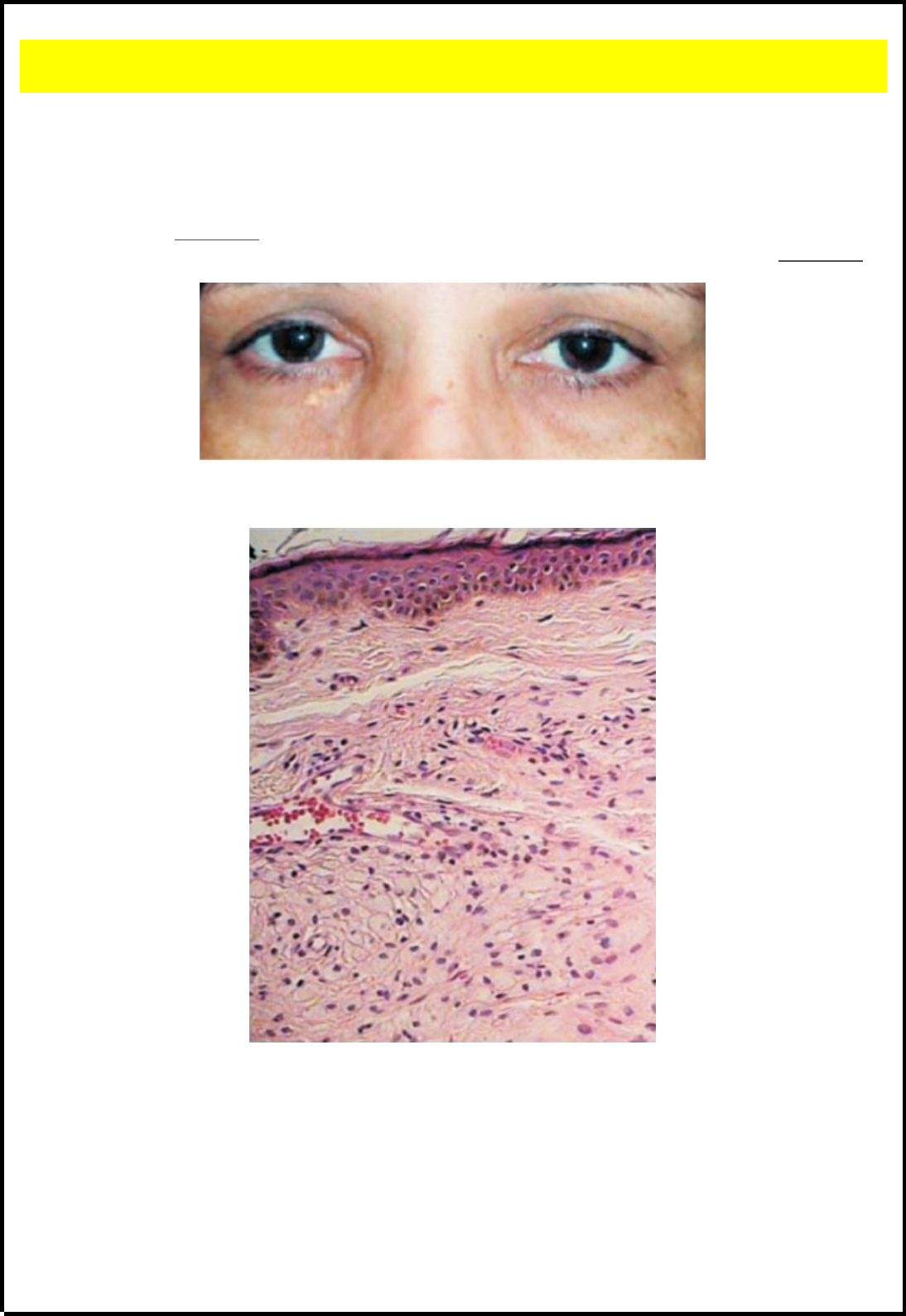 Grátis: Xantelasma - Material Claro e Objetivo em PDF para Estudo Rápido, image size:1094x1588