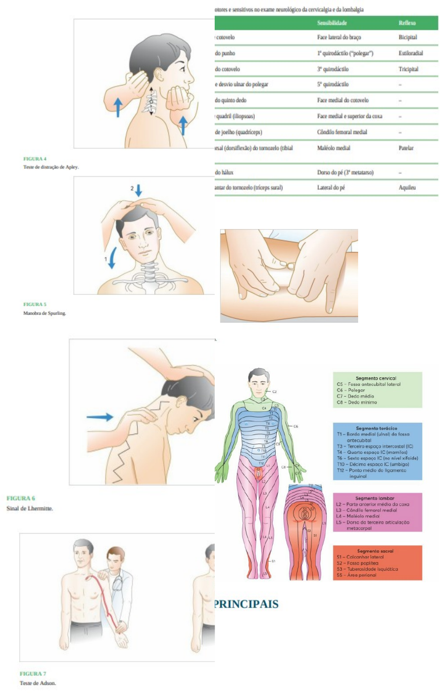 Grátis: CERVICALGIA-apg 1 - Material Claro e Objetivo em PDF para Estudo  Rápido