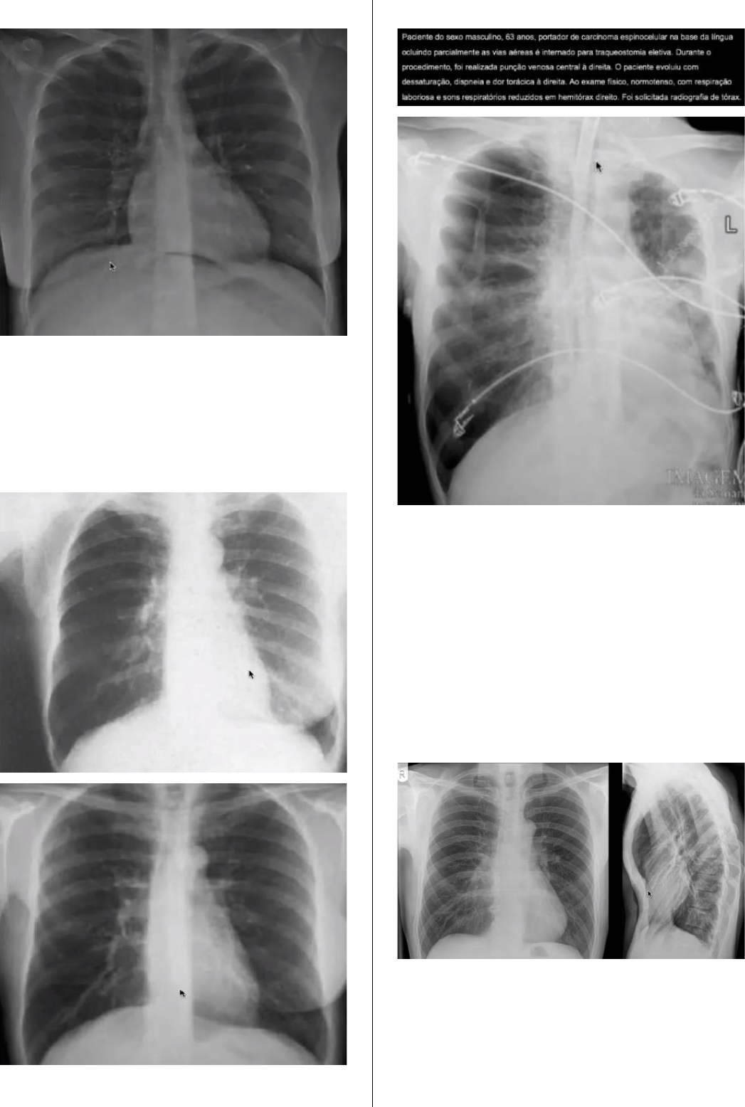 Casos Clínicos - Raio-X de Tórax - Radiologia