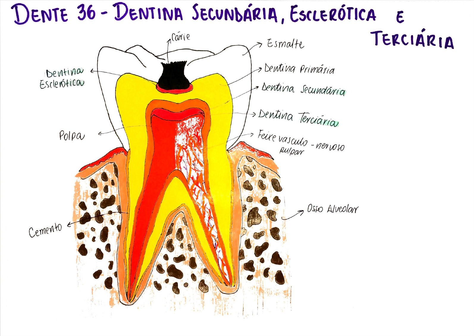 Tipos De Dentina Cariologia