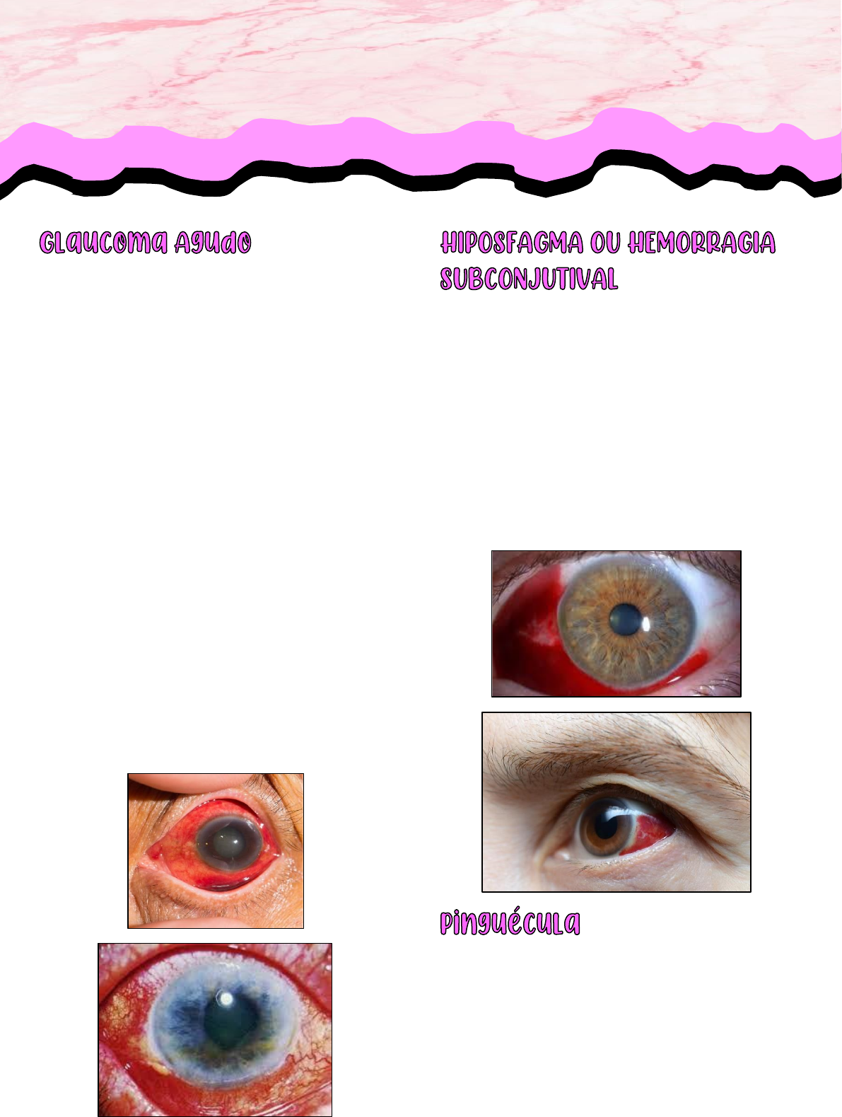 ResuMED de síndrome do olho vermelho: causas, exames e mais!