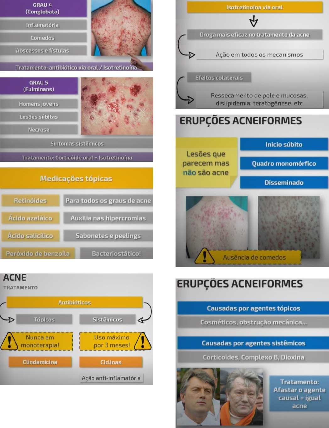 Grátis: Acne - Material Claro e Objetivo em PDF para Estudo Rápido, image size:1047x1360