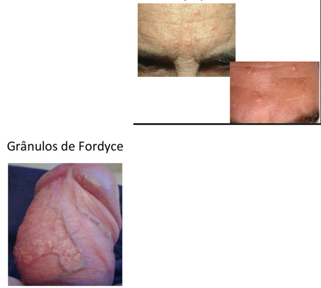 REVISÃO PRÁTICA 2 DERMATO - Dermatologia